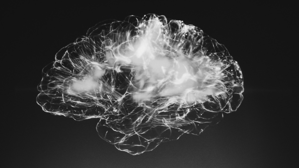 An x-ray picture of a human brain